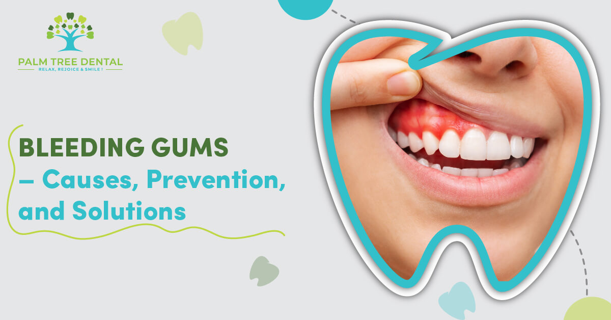 Bleeding Gums – Causes, Prevention, And Solutions | Palm Tree Dental