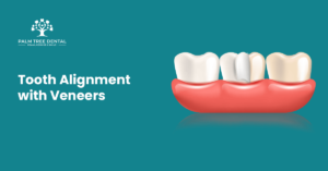 Tooth Alignment With Veneers | Palm Tree Dental